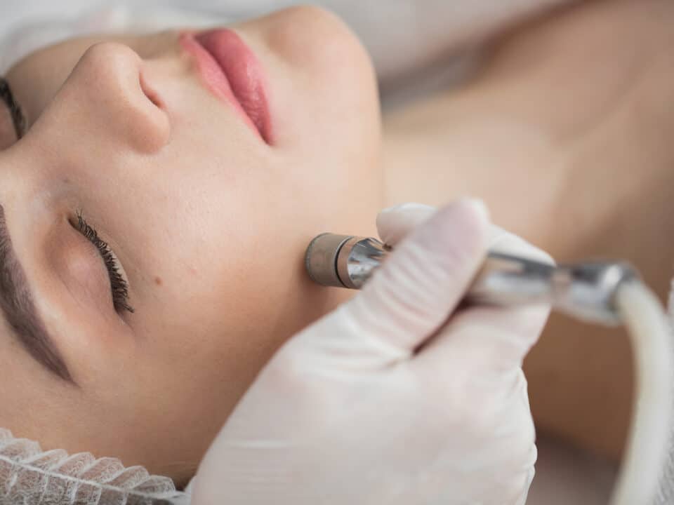 Diamond microdermabrasion, peeling cosmetic. woman during a microdermabrasion treatment in beauty salon.