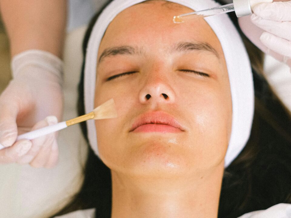 chemical peel eastern idaho